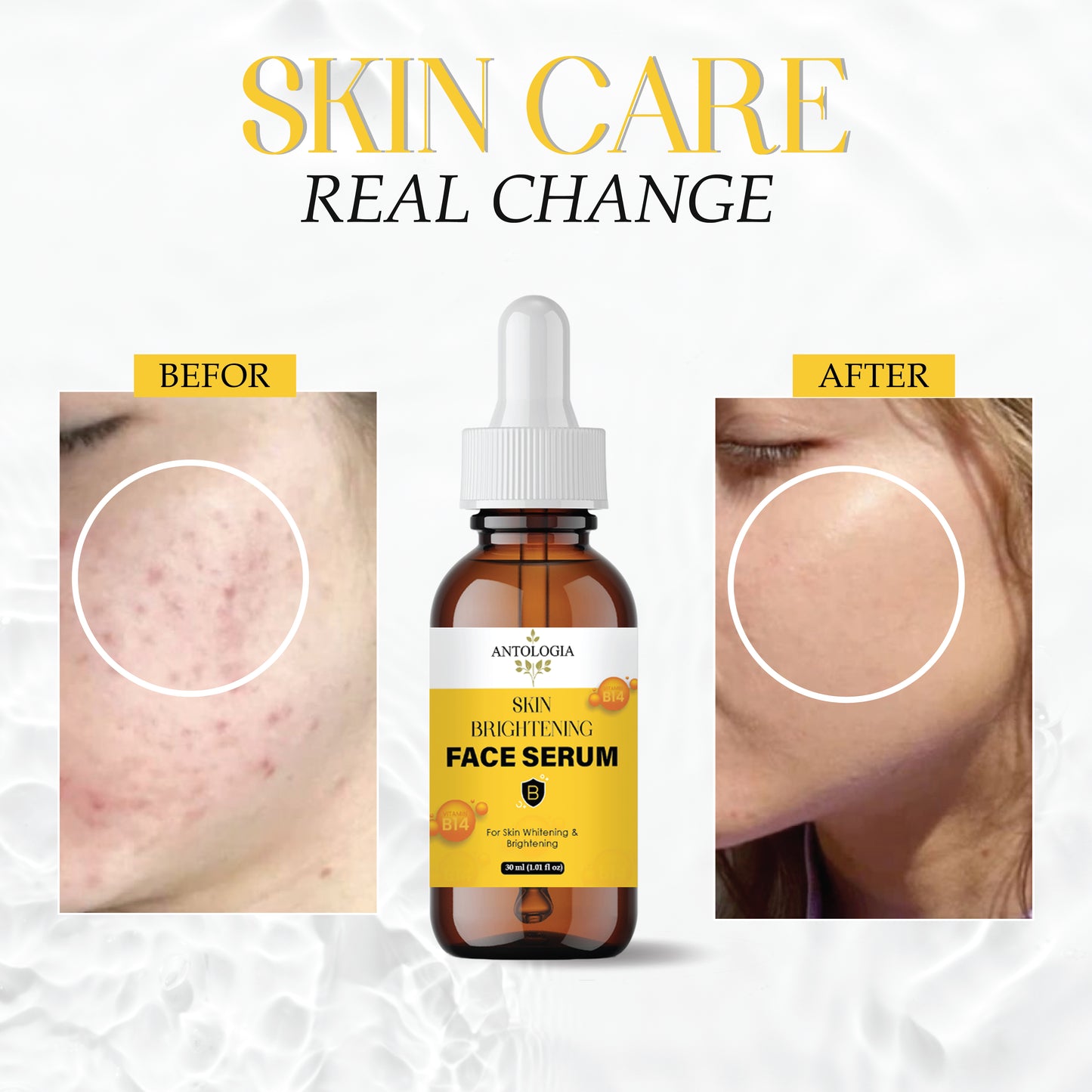 Skin Brightening Serum with Vitamin C, Niacinamide & Hyaluronic Acid | Dark Spot Corrector | Evens Skin Tone | Hydrating Face Serum for Radiant & Glowing Skin – 30ml