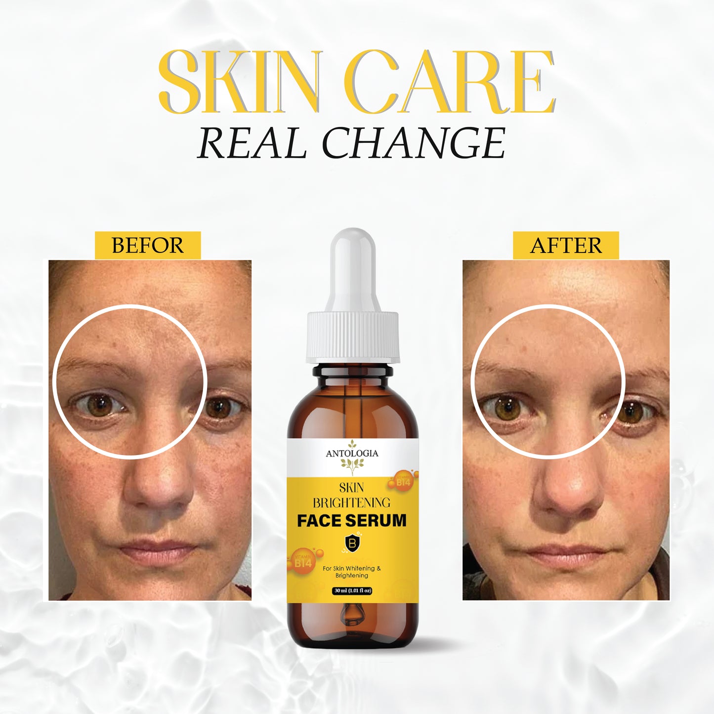 Skin Brightening Serum for Glowing & Even Skin Tone | Reduces Dark Spots, Pigmentation & Dullness | Lightweight & Non-Greasy Formula – 30ml