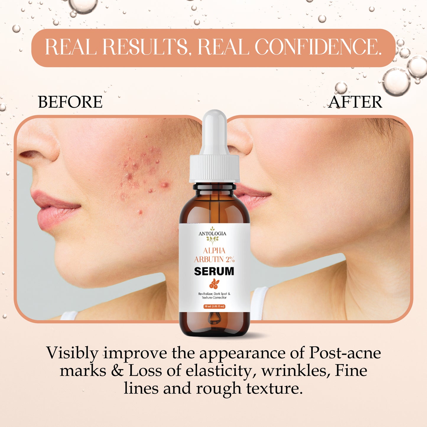 Alpha Arbutin Serum for Skin Brightening | Dark Spot Remover | Even Skin Tone & Radiance | Lightweight, Fast Absorbing Face Serum