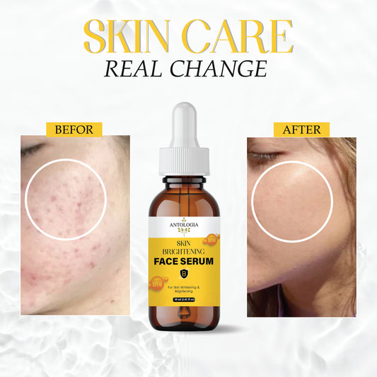 Skin Brightening Serum for Glowing & Even Skin Tone | Reduces Dark Spots, Pigmentation & Dullness | Lightweight & Non-Greasy Formula – 30ml